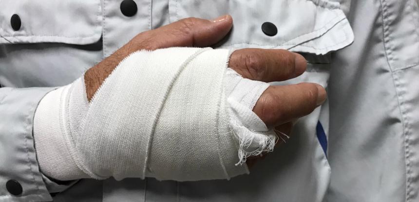 This image shows a man with his hand wrapped in a cast after a workplace injury