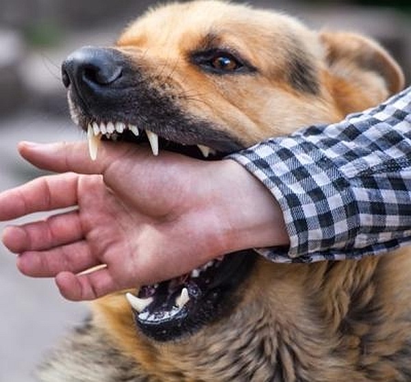 What are defenses in North Carolina dog bite cases?