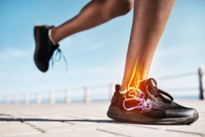 Repetitive stress injury, repetitive stress injury lawyer, 1Charlotte Injury Lawyers for repetitive stress injury cases, workers compensation repetitive stress injury claim. 
