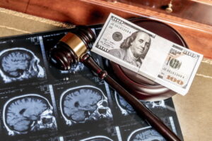 Brain MRI images and gavel represent a traumatic brain injury lawsuit in North Carolina